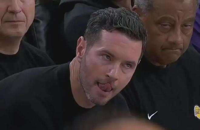 東契奇又傷了！湖人給快船送溫暖