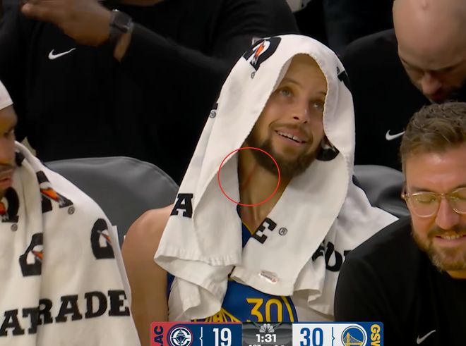 開場脖子就被抓傷！庫里：我也不知道誰抓的，實際上也沒多疼