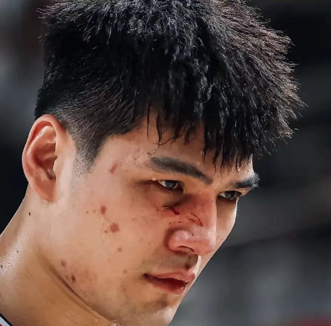 伤痕明显！广州状元陈国豪面部骨裂 季后赛大概率戴面具对阵广东