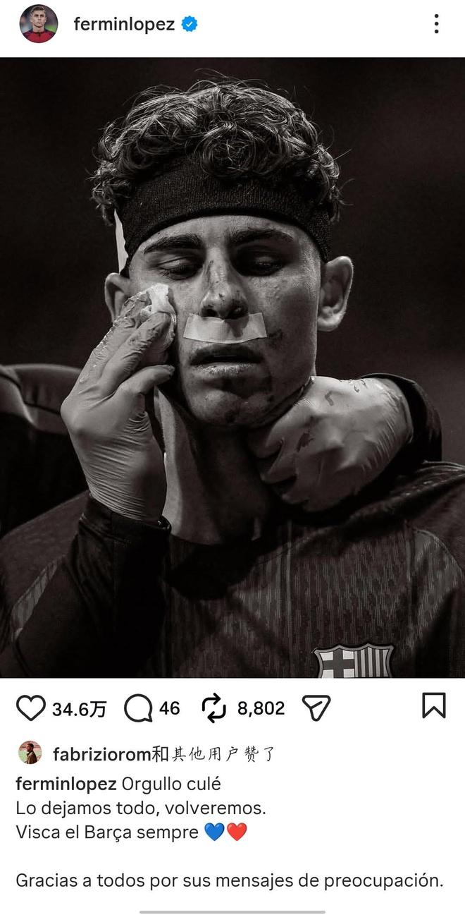 费尔明社媒晒脸部受伤照:我们付出了一切,我们会再回来的 费尔明社媒晒脸部受伤照:我们付出了一切,我们会再回来的