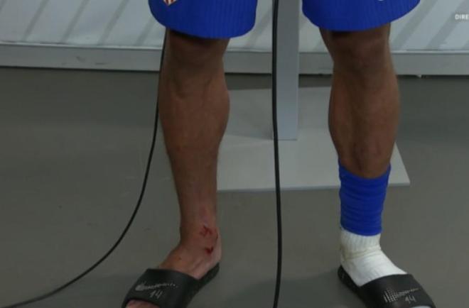 世体：略伦特的脚踝伤势较为严重，预计将无法出战赫塔费