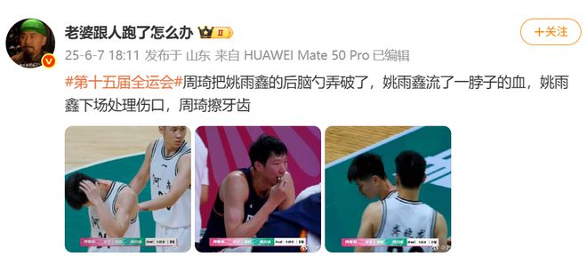 ⚡血洒赛场！媒体人：周琦牙齿撞到姚雨鑫后脑勺，后者流了一脖子的血