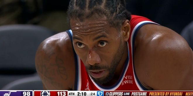 小卡末節(jié)20分細節(jié)：上籃時臉被摳出血 爵士竟挑戰(zhàn)成功激出戰(zhàn)神卡