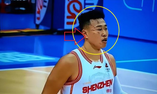 可憐！一只手防守，一只手護自己的臉 球迷：CBA太可怕了