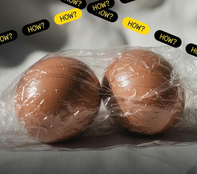 做公益，多特主場對陣美因茨賽前免費為球迷篩查睪丸癌