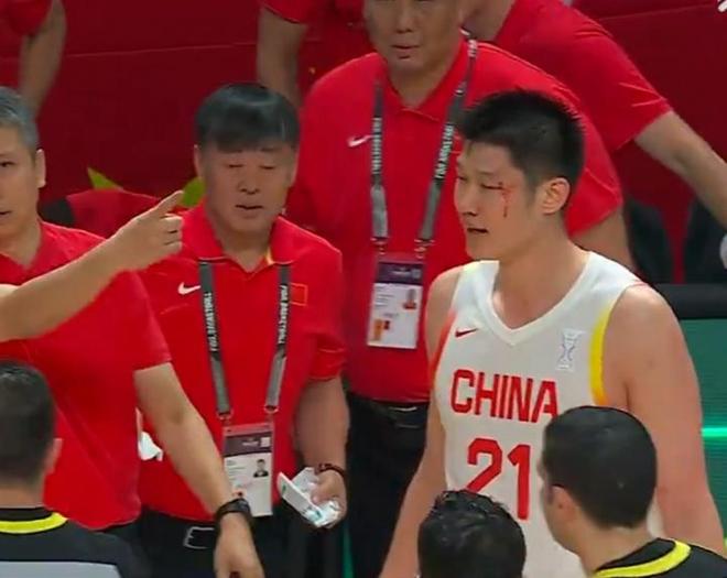 胡金秋眉骨被打开！杨健：这是泰拳啊？周琦：我也被打不过没出血