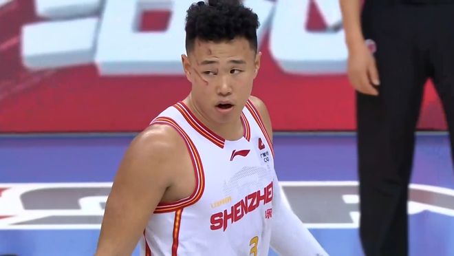 CBA强度这么大？国手后卫遭九阴白骨爪袭击，面部血痕累累不犯规