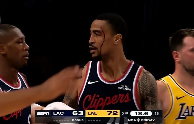 惜败湖人！伦纳德柯林斯伤情更新，马瑟林+卢采访中极度不满判罚