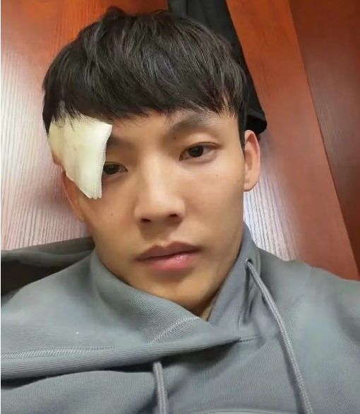 报平安！徐杰缝3针晒照庆祝新赛季开门红 杜锋：希望他快点好起来