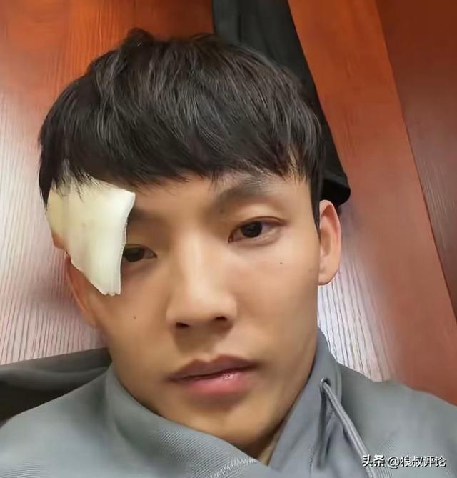 眉骨缝了三针！徐杰更新社媒报平安：“新赛季 为广东而战”