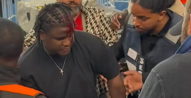 图片报：于帕的朋友观战欧冠半决赛时被一玻璃瓶砸中，头破血流