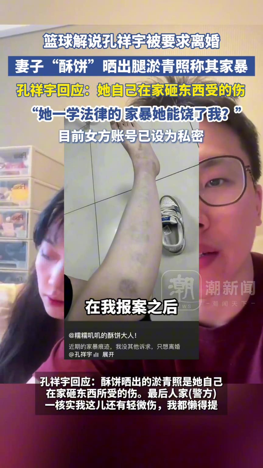 篮球解说孔祥宇被要求离婚，妻子“酥饼”晒腿淤青照称其家暴！