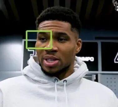 NBA球星字母哥“眼角淤青”，赛后自曝原因：在超市见义勇为，制服抢劫歹徒，被打到眼睛